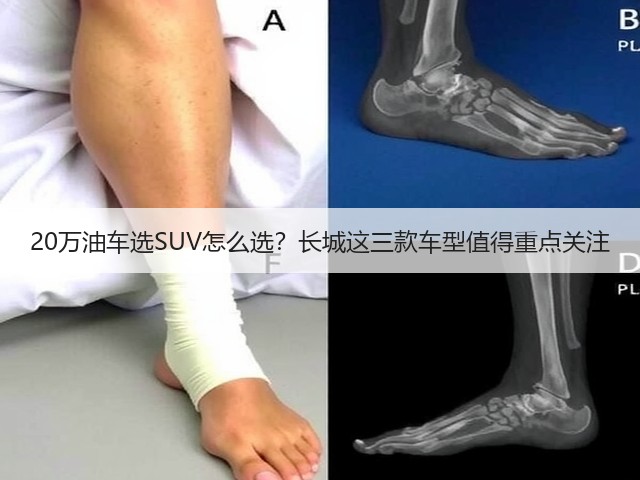 20万油车选SUV怎么选?长城这三款车型值得重点关注(图2) 20万油车选SUV怎么选?长城这三款车型值得重点关注(图2)